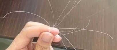 白头发别急着拔！重新变黑发的方法找到了